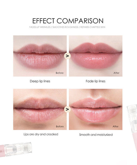 3 In 1 Lip Care Roller Needle Roller Lip Roller Beard Growth Roller Beard Hair Growth Roller Beard Treatment & Serum Applicant